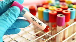 CRS: Odontogene Ursachen werden oft übersehen CRS: Odontogene Ursachen werden oft übersehen