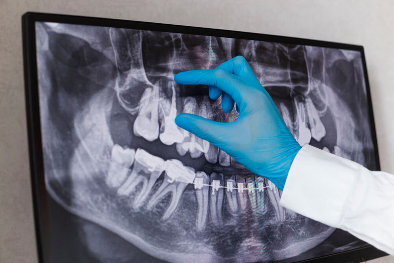3D-Bildgebung: KI unterstützt bei DVTs und CTs