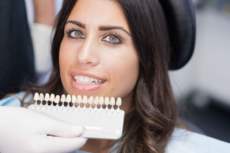 10-Jahre-Nachbeobachtungsstudie: Veneers bei Fluorose