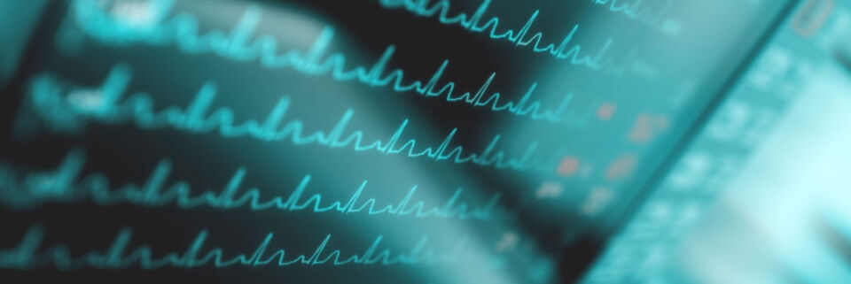 Für mehr Sicherheit im Netzwerk müssen die verschiedenen Geräte ihren Status kommunizieren, Sophos spricht auch von synchronisierter Sicherheit und dem Security Heartbeat. Für mehr Sicherheit im Netzwerk müssen die verschiedenen Geräte ihren Status kommunizieren, Sophos spricht auch von synchronisierter Sicherheit und dem Security Heartbeat.