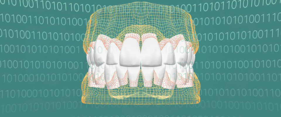Bei Heraeus Kulzer geht niemand auf dem Zahnfleisch und kein Zahn bröckelt; denn das Dentalunternehmen digitalisierte und optimierte: Alle Zähne passen. Bei Heraeus Kulzer geht niemand auf dem Zahnfleisch und kein Zahn bröckelt; denn das Dentalunternehmen digitalisierte und optimierte: Alle Zähne passen.
