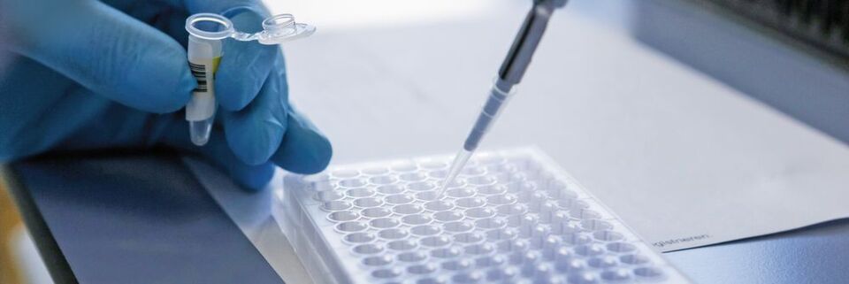 Abb. 1: Die Biocrates-Kits ermöglichen sowohl die automatisierte, als auch die händische Durchführung der Probenvorbereitung im 96-well-plate-Format. Abb. 1: Die Biocrates-Kits ermöglichen sowohl die automatisierte, als auch die händische Durchführung der Probenvorbereitung im 96-well-plate-Format.