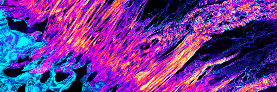 Fluoreszenz-Mikroskopbild des Übergangs von Sehne (links unten) zu Knochen (rechts oben). In der Mitte sind die feinen Fasern des Collagen-Typs 2 zu sehen. Fluoreszenz-Mikroskopbild des Übergangs von Sehne (links unten) zu Knochen (rechts oben). In der Mitte sind die feinen Fasern des Collagen-Typs 2 zu sehen.