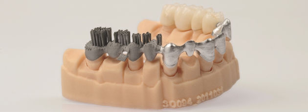Additiv gefertigte Zahn-Brücke. In der Zahnmedizin haben sich 3D-gedruckte Prothesen zunehmend etabliert. Auf dem 3D-Druck-Kongress in Mainz wollen führende Forscher und Mediziner weitere Anwendungsfelder in der Gesundheitstechnik erschließen. Additiv gefertigte Zahn-Brücke. In der Zahnmedizin haben sich 3D-gedruckte Prothesen zunehmend etabliert. Auf dem 3D-Druck-Kongress in Mainz wollen führende Forscher und Mediziner weitere Anwendungsfelder in der Gesundheitstechnik erschließen.