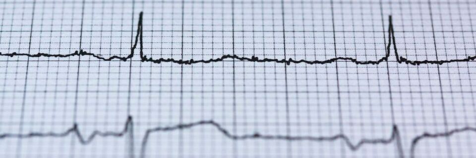 Ein Finanzierungsvolumen von 15 Mio. Euro erhält Cardior Pharmaceuticals. Das junge Biotechnologie-Unternehmen arbeitet an RNA-basierten Therapeutika für Patienten mit Herzerkrankungen. Ein Finanzierungsvolumen von 15 Mio. Euro erhält Cardior Pharmaceuticals. Das junge Biotechnologie-Unternehmen arbeitet an RNA-basierten Therapeutika für Patienten mit Herzerkrankungen.