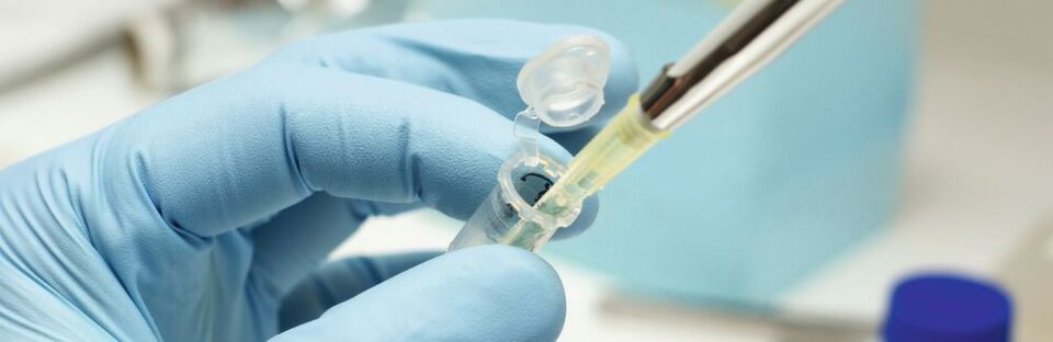 Abb. 1: Exaktes Pipettieren ist entscheidend für richtige und reproduzierbare Analysenergebnisse. Abb. 1: Exaktes Pipettieren ist entscheidend für richtige und reproduzierbare Analysenergebnisse.
