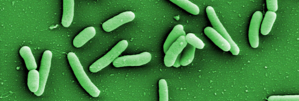Bakterien der Art Pseudomonas aeruginosa sind äußerst widerstandsfähig und kommen fast überall vor. Bakterien der Art Pseudomonas aeruginosa sind äußerst widerstandsfähig und kommen fast überall vor.