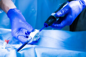 Innovative Katheter-Lösungen wie diese aus dem Hause Freudenberg Medical vereinfachen minimal-invasive Eingriff. Unverzichtbare Voraussetzung ist dafür deren Herstellung gemäß höchsten Qualitätsanforderungen. Innovative Katheter-Lösungen wie diese aus dem Hause Freudenberg Medical vereinfachen minimal-invasive Eingriff. Unverzichtbare Voraussetzung ist dafür deren Herstellung gemäß höchsten Qualitätsanforderungen.