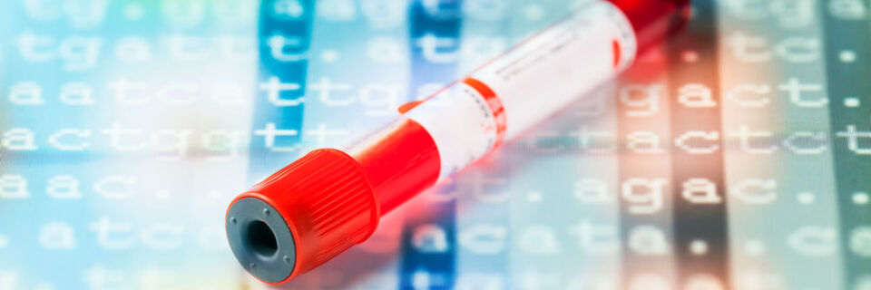 Im Blut zirkulierenden Tumorzellen können aus der Blutprobe eines Patienten isoliert und im Anschluss charakterisiert werden. Um verlässliche Ergebnisse zu garantieren, müssen alle internen Prozesse der jeweiligen Systeme genau definiert, gemessen und kontrolliert werden – hier kommt Sensortechnik ins Spiel. Im Blut zirkulierenden Tumorzellen können aus der Blutprobe eines Patienten isoliert und im Anschluss charakterisiert werden. Um verlässliche Ergebnisse zu garantieren, müssen alle internen Prozesse der jeweiligen Systeme genau definiert, gemessen und kontrolliert werden – hier kommt Sensortechnik ins Spiel.