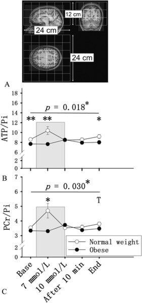 Zielregion der 31P-MRS-Messungen im Gehirn (sagittal, coronal, transversal (A). Mittelwerte ± Standardfehler der Quotienten aus Adenosintriphosphat (B) und Phosphocreatin (C) zu anorganischem Phosphat bei adipösen (schwarze Kreise) und normalgewichtigen (weiße Kreise) Studienteilnehmern. Das graue Feld markiert die intravenöse Gabe von 20%iger Glukose. Die Daten wurden mittels zweifaktorieller ANOVA inkl. Bonferroni-Korrektur sowie ungepaarten Student t-Tests für Gruppenvergleiche analysiert. Angezeigt wird der Interaktionseffekt zwischen den Faktoren Gruppe (adipös, Kontrolle) und Zeit. Tp < 0.1; *p < 0.05; **p < 0.01. (Quelle: ) Zielregion der 31P-MRS-Messungen im Gehirn (sagittal, coronal, transversal (A). Mittelwerte ± Standardfehler der Quotienten aus Adenosintriphosphat (B) und Phosphocreatin (C) zu anorganischem Phosphat bei adipösen (schwarze Kreise) und normalgewichtigen (weiße Kreise) Studienteilnehmern. Das graue Feld markiert die intravenöse Gabe von 20%iger Glukose. Die Daten wurden mittels zweifaktorieller ANOVA inkl. Bonferroni-Korrektur sowie ungepaarten Student t-Tests für Gruppenvergleiche analysiert. Angezeigt wird der Interaktionseffekt zwischen den Faktoren Gruppe (adipös, Kontrolle) und Zeit. Tp < 0.1; *p < 0.05; **p < 0.01. (Quelle: )