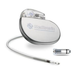Innovatives Implantat: Die Kardiokapsel ist ein kleiner Herzschrittmacher, der über einen Katheter implantiert wird. Er ist sehr viel kleiner als herkömmliche Herzschrittmacher und hat ungefähr die Größe einer großen Vitaminkapsel. Im Gegensatz zu herkömmlichen Schrittmachern wird die Kardiokapsel vom Bein aus in das Herz eingebracht und benötigt keine Elektrode. Innovatives Implantat: Die Kardiokapsel ist ein kleiner Herzschrittmacher, der über einen Katheter implantiert wird. Er ist sehr viel kleiner als herkömmliche Herzschrittmacher und hat ungefähr die Größe einer großen Vitaminkapsel. Im Gegensatz zu herkömmlichen Schrittmachern wird die Kardiokapsel vom Bein aus in das Herz eingebracht und benötigt keine Elektrode.