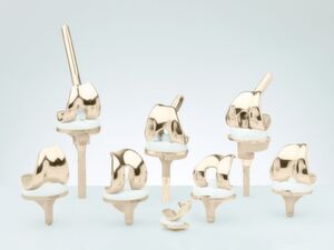 Knie-Endoprothesen: Innovative Oberflächenbeschichtungenverbessern die mechanischen Eigenschaften und beugen zudem allergischen Reaktionen vor. Knie-Endoprothesen: Innovative Oberflächenbeschichtungenverbessern die mechanischen Eigenschaften und beugen zudem allergischen Reaktionen vor.