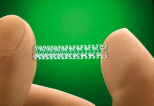 So sieht es aus: ein biologisch abbaubares, medikamentenfreisetzendes Gefäßgerüst (bioresorbable vascular scaffold, BVS) aus dem Hause Abbott. So sieht es aus: ein biologisch abbaubares, medikamentenfreisetzendes Gefäßgerüst (bioresorbable vascular scaffold, BVS) aus dem Hause Abbott.