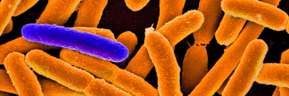 Manche Bakterien überdauern Antibiotikabehandlungen in einer Art Winterschlaf. (Beispielbild: Elektronenmikroskopie-Aufnahme von Escherichia coli; eingefärbt) Manche Bakterien überdauern Antibiotikabehandlungen in einer Art Winterschlaf. (Beispielbild: Elektronenmikroskopie-Aufnahme von Escherichia coli; eingefärbt)