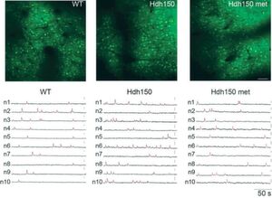 Hochauflösende Zwei-Photonen Mikroskopie-Aufnahmen, die über einen Ca-Indikator aktive Nervenzellen detektieren. Darunter sind die Aktivitätsableitungen des neuronalen Netzwerks. Ein kleiner Peak ist dabei immer eine aktiv feuernde Zelle. In der nicht mit Metformin behandelten Hdh150 (Huntington, Mitte) Spur sind deutlich mehr Peaks zu sehen, als in der Kontrolle (links) und im Metformin behandelten Hdh150 Tier ( rechts). Hochauflösende Zwei-Photonen Mikroskopie-Aufnahmen, die über einen Ca-Indikator aktive Nervenzellen detektieren. Darunter sind die Aktivitätsableitungen des neuronalen Netzwerks. Ein kleiner Peak ist dabei immer eine aktiv feuernde Zelle. In der nicht mit Metformin behandelten Hdh150 (Huntington, Mitte) Spur sind deutlich mehr Peaks zu sehen, als in der Kontrolle (links) und im Metformin behandelten Hdh150 Tier ( rechts).