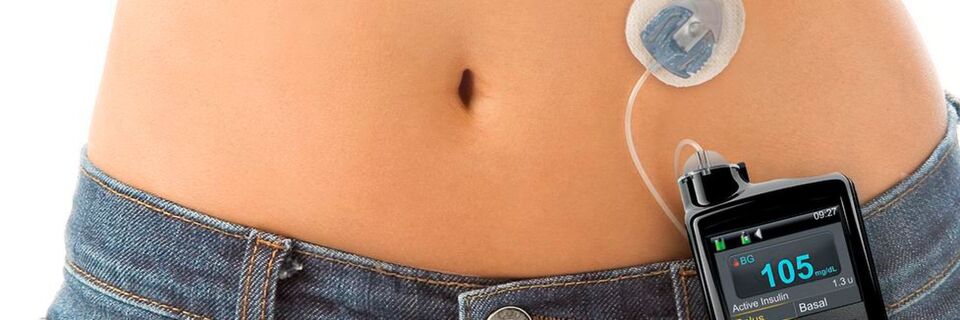 Wearables lassen sich beispielsweise zur Behandlung von Diabetes einsetzen – wie dieses Insulinpumpensystem mit Sensor und Sender. Wearables lassen sich beispielsweise zur Behandlung von Diabetes einsetzen – wie dieses Insulinpumpensystem mit Sensor und Sender.