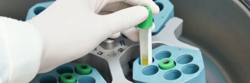 Tischzentrifugen müssen bei hohen Drehzahlen leise arbeiten und wenig Energie verbrauchen – dafür ist geeignete Antriebstechnik gefragt. Tischzentrifugen müssen bei hohen Drehzahlen leise arbeiten und wenig Energie verbrauchen – dafür ist geeignete Antriebstechnik gefragt.
