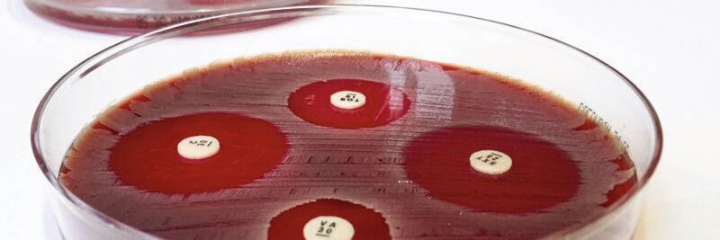 Der Agardiffusionstest macht Antibiotika-Resistenzen sichtbar. Der Agardiffusionstest macht Antibiotika-Resistenzen sichtbar.