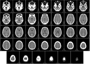 Bilder einer Computertomographie: Gerade in der Medizintechnik eröffnet künstliche Intelligenz vielversprechende Möglichkeiten, beispielsweise bei der Bilderkennung von Tumorzellen. Bilder einer Computertomographie: Gerade in der Medizintechnik eröffnet künstliche Intelligenz vielversprechende Möglichkeiten, beispielsweise bei der Bilderkennung von Tumorzellen.