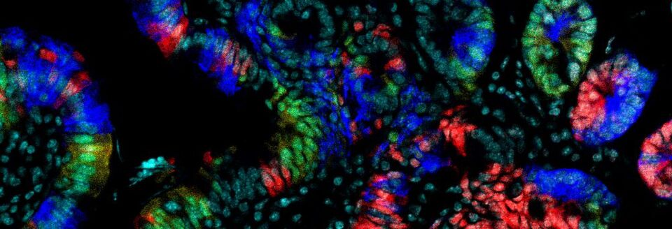 Schnitt durch den Darm: Oberste Zellschicht der Darmwand, sichtbar gemacht durch verschiedene fluoreszierende Proteine (Mausmodell). Schnitt durch den Darm: Oberste Zellschicht der Darmwand, sichtbar gemacht durch verschiedene fluoreszierende Proteine (Mausmodell).