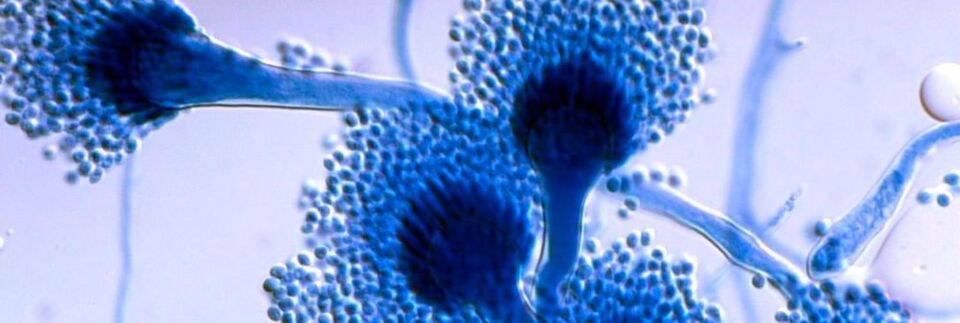 Bild des Schimmelpilzes Aspergillus fumigatus in Vergrößerung. Bild des Schimmelpilzes Aspergillus fumigatus in Vergrößerung.