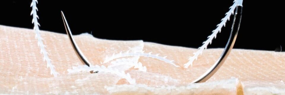 Innovation von Biomedizinern aus Denkendorf: Barbed Sutures. Dabei handelt es sich um einen mit Widerhaken versehenen chirurgischen Nähfaden. Innovation von Biomedizinern aus Denkendorf: Barbed Sutures. Dabei handelt es sich um einen mit Widerhaken versehenen chirurgischen Nähfaden.