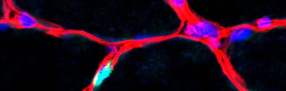 Skelettmuskulatur: Die Kerne der Muskelstammzellen sind in grün zu sehen. Die Zellkerne der Muskelfasern sind in blau, die Umgrenzung um die Muskelfasern (Basallamina) ist rot. Maßstab: 20µm. Skelettmuskulatur: Die Kerne der Muskelstammzellen sind in grün zu sehen. Die Zellkerne der Muskelfasern sind in blau, die Umgrenzung um die Muskelfasern (Basallamina) ist rot. Maßstab: 20µm.