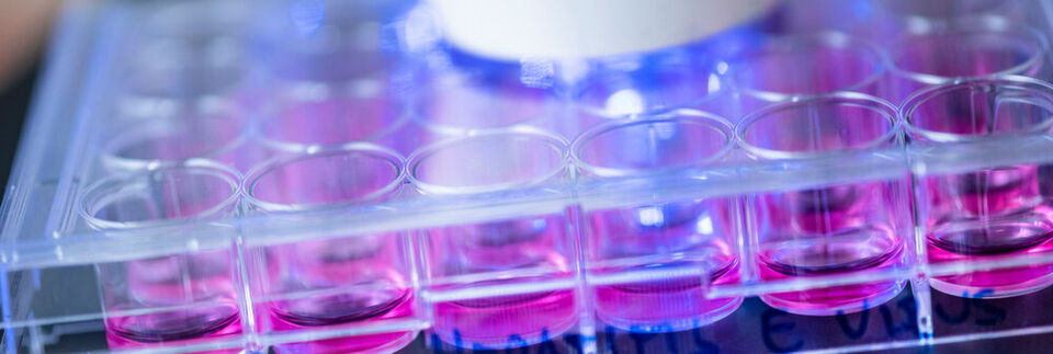 Humane Hepatoma-Zellen, die mit Hepatitis-E-Viren infiziert wurden, werden in der Immunfluoreszenz analysiert. Humane Hepatoma-Zellen, die mit Hepatitis-E-Viren infiziert wurden, werden in der Immunfluoreszenz analysiert.