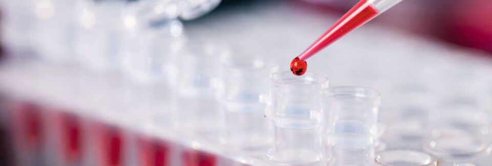 Abb. 1: Ob PCR, Verdünnungsreihe oder ELISA – Pipettieren gehört zu den wesentlichen Routine-Aufgaben im Labor. Präzision ist hier oberstes Gebot. Abb. 1: Ob PCR, Verdünnungsreihe oder ELISA – Pipettieren gehört zu den wesentlichen Routine-Aufgaben im Labor. Präzision ist hier oberstes Gebot.