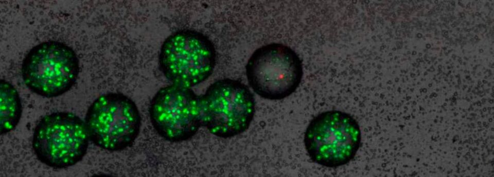 Mikro-Gel-Kügelchen mit grün fluoreszierenden Sensor-Bakterien. In einem der Kügelchen (Mitte) wurden die Sensor-Bakterien von einem Wirkstoff abgetötet (mikroskopische Aufnahme). Mikro-Gel-Kügelchen mit grün fluoreszierenden Sensor-Bakterien. In einem der Kügelchen (Mitte) wurden die Sensor-Bakterien von einem Wirkstoff abgetötet (mikroskopische Aufnahme).