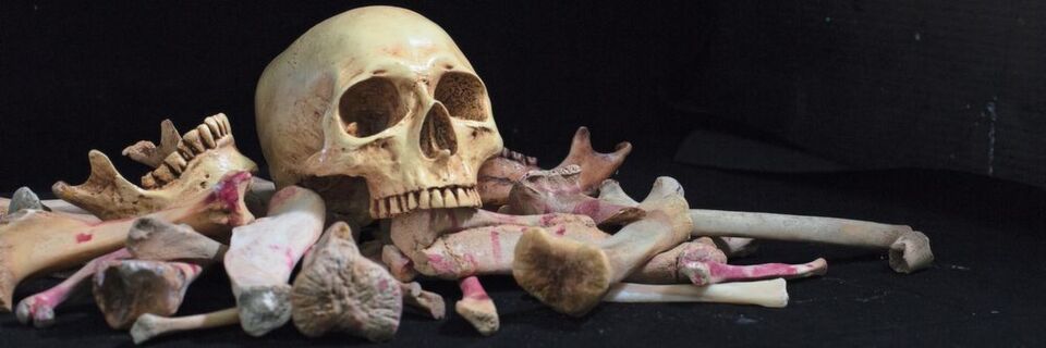 In Stuttgart arbeiten Forscher an 3D-druckbarer Knochentinte, die im Körper selbst Knochengewebe bildet und damit zerstörtes Originalgewebe ersetzen soll. In Stuttgart arbeiten Forscher an 3D-druckbarer Knochentinte, die im Körper selbst Knochengewebe bildet und damit zerstörtes Originalgewebe ersetzen soll.
