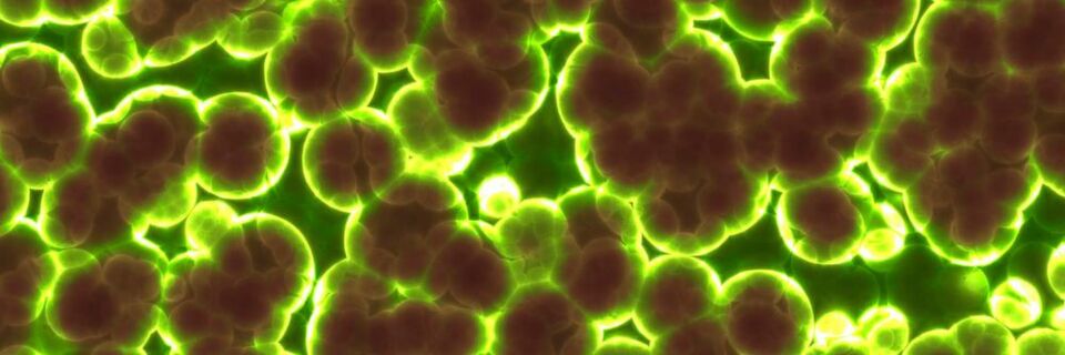 Ein Studierenden-Projekt will Strom von Bakterien nutzen um biologische Batterien zu entwickeln. Ein Studierenden-Projekt will Strom von Bakterien nutzen um biologische Batterien zu entwickeln.