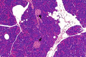 Fettzellen (weiß) und Langerhans-Inseln (schwarze Pfeile) in der Bauchspeicheldrüse einer diabetesanfälligen New Zealand Obese (NZO)-Maus. Lichtmikroskopische Aufnahme, Maßstab 200 Mikromet Fettzellen (weiß) und Langerhans-Inseln (schwarze Pfeile) in der Bauchspeicheldrüse einer diabetesanfälligen New Zealand Obese (NZO)-Maus. Lichtmikroskopische Aufnahme, Maßstab 200 Mikromet
