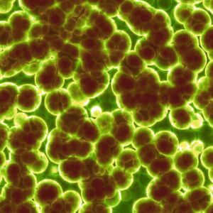 Ein Studierenden-Projekt will Strom von Bakterien nutzen um biologische Batterien zu entwickeln. Ein Studierenden-Projekt will Strom von Bakterien nutzen um biologische Batterien zu entwickeln.