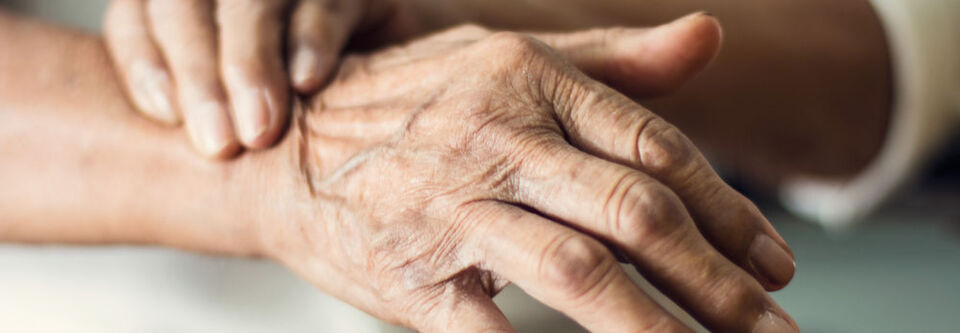 Bei der Parkinson-Erkrankung verbreiten sich anormale Proteine im Gehirn. Oxidativer Stress könnte dafür eine treibende Kraft sein. Bei der Parkinson-Erkrankung verbreiten sich anormale Proteine im Gehirn. Oxidativer Stress könnte dafür eine treibende Kraft sein.