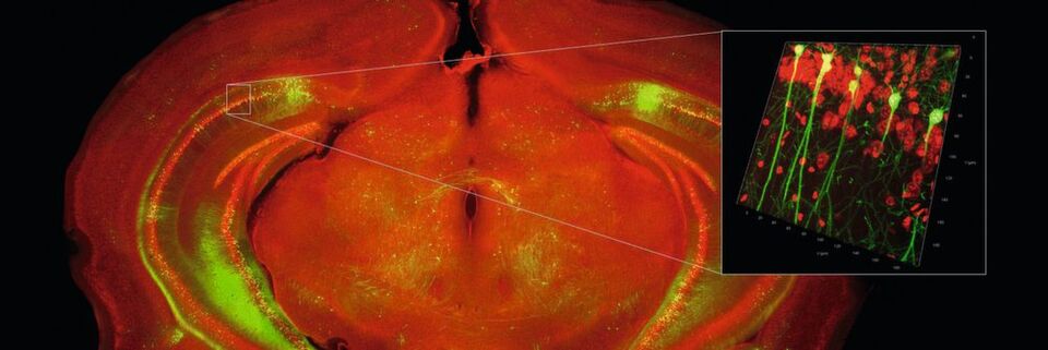 Abb. 1: Übersicht über den mit einem automatisierten Weitfeldmikroskop aufgenommenen Gehirnschnitt der Maus und 3D-Rendering einer Region im Hippocampus (Zellkerne in rot. Hippocampale Neuronen in grün). Abb. 1: Übersicht über den mit einem automatisierten Weitfeldmikroskop aufgenommenen Gehirnschnitt der Maus und 3D-Rendering einer Region im Hippocampus (Zellkerne in rot. Hippocampale Neuronen in grün).