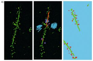 Abb.3A: Rohdaten-Fluoreszenzbild (links) und KI-Segmentierung (Mitte) eines einzelnen Schnitts des z-Stapels aus Abb. 2 (Hintergrund cyan, Dendriten orange, Dornenfortsätze magentafarben). Der rechte Bereich zeigt das KI-Ergebnis eines andere Schnittes des z-Stapels (Dendriten in grün, Hintergrund in cyan und Dornenfortsätze in rot). Abb.3A: Rohdaten-Fluoreszenzbild (links) und KI-Segmentierung (Mitte) eines einzelnen Schnitts des z-Stapels aus Abb. 2 (Hintergrund cyan, Dendriten orange, Dornenfortsätze magentafarben). Der rechte Bereich zeigt das KI-Ergebnis eines andere Schnittes des z-Stapels (Dendriten in grün, Hintergrund in cyan und Dornenfortsätze in rot).