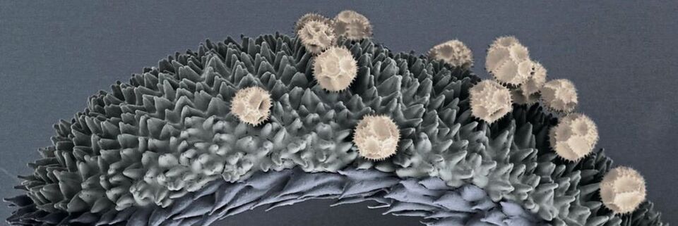 Zur Bestäubung haften Pollen auf der so genannten Narbe in der Blüte der Hypochoeris radicata, wie die kolorierte Aufnahme aus dem Rasterelektronenkryomikroskop zeigt. Zur Bestäubung haften Pollen auf der so genannten Narbe in der Blüte der Hypochoeris radicata, wie die kolorierte Aufnahme aus dem Rasterelektronenkryomikroskop zeigt.