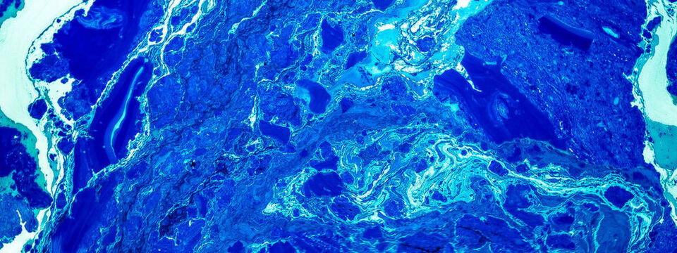 Die steigende Dichte und Hitze-Entwicklung in den High-Performance- und Supercomputing-Cluster erfordert Flüssigkühlung. Am „Wie“ wird noch getüftelt, wenngleich die Heißwasserkühlung bereits große Forschritte macht. Die steigende Dichte und Hitze-Entwicklung in den High-Performance- und Supercomputing-Cluster erfordert Flüssigkühlung. Am „Wie“ wird noch getüftelt, wenngleich die Heißwasserkühlung bereits große Forschritte macht.