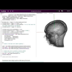 3D-Visualisierung eines MRI-Scans eines menschlichen Gehirns mithilfe von Mozilla Iodide 3D-Visualisierung eines MRI-Scans eines menschlichen Gehirns mithilfe von Mozilla Iodide