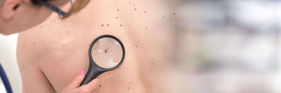 Allgemeinmediziner können Hauterkrankungen oft nicht richtig diagnostizieren. Ein Google-AI-Team forscht an einer Dermatologie-KI. Allgemeinmediziner können Hauterkrankungen oft nicht richtig diagnostizieren. Ein Google-AI-Team forscht an einer Dermatologie-KI.