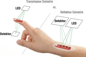 Bild 2:
Zwei verschiedene Messprinzipien der Oximetrie, transmissiv und reflektiv. Bild 2:
Zwei verschiedene Messprinzipien der Oximetrie, transmissiv und reflektiv.