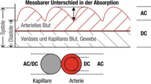 Bild 3:
Schematische Darstellung der Lichtabsorption durch ein Pulsoximeter. Bild 3:
Schematische Darstellung der Lichtabsorption durch ein Pulsoximeter.