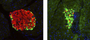 On the left, a pancreatic islet of a healthy mouse (in red, cells producing insulin). On the right, a pancreatic islet of an insulin deficient mouse (cells producing insulin are virtually absent). On the left, a pancreatic islet of a healthy mouse (in red, cells producing insulin). On the right, a pancreatic islet of an insulin deficient mouse (cells producing insulin are virtually absent).