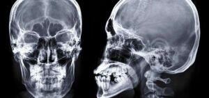 T-rays could replace X-rays as a non-destructive alternative means of medical imaging. T-rays could replace X-rays as a non-destructive alternative means of medical imaging.
