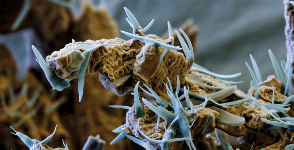 A view into the catalysis microcosm: scanning electron microscope image of a ligand (Picture: BASF) A view into the catalysis microcosm: scanning electron microscope image of a ligand (Picture: BASF)