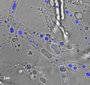 Abb. 1: Mikroskopische Aufnahme des Myzel-bildenden Boden Mikroorganimus Pythium ultimum welcher Phenanthren in seinem Zellinnern transportiert: Overlay eines Durchlicht- und Fluoreszenzbildes von Pythium ultimum, dessen Hyphen Phenanthren-angereicherte Vesikel (in blau) enthalten. Abb. 1: Mikroskopische Aufnahme des Myzel-bildenden Boden Mikroorganimus Pythium ultimum welcher Phenanthren in seinem Zellinnern transportiert: Overlay eines Durchlicht- und Fluoreszenzbildes von Pythium ultimum, dessen Hyphen Phenanthren-angereicherte Vesikel (in blau) enthalten.