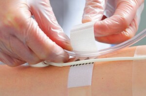 Bild 1: Die „BeneHold“-Fixierstreifen lassen sich auch mit Handschuhen leicht verwenden