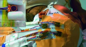 Vier im Bereich der motorischen und sensorischen Gehirnareale auf den Kopf eines Probanden geklebte CSAM-Magnetfeldsensoren. Die würfelförmigen Sensoren sind ähnlich einfach zu handhaben wie Elektroden. Kleines Bild: Dimension des Sensors und der zur lokalen Modulation des Feldes auf den Sensor aufgebrachten Spule (in der Aufsicht auf den Würfel). Vier im Bereich der motorischen und sensorischen Gehirnareale auf den Kopf eines Probanden geklebte CSAM-Magnetfeldsensoren. Die würfelförmigen Sensoren sind ähnlich einfach zu handhaben wie Elektroden. Kleines Bild: Dimension des Sensors und der zur lokalen Modulation des Feldes auf den Sensor aufgebrachten Spule (in der Aufsicht auf den Würfel).