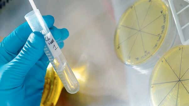 The advantage of using microorganisms to produce components needed for substances such as polyurethanes is that they rely on biomass such as corn starch or straw as base materials The advantage of using microorganisms to produce components needed for substances such as polyurethanes is that they rely on biomass such as corn starch or straw as base materials